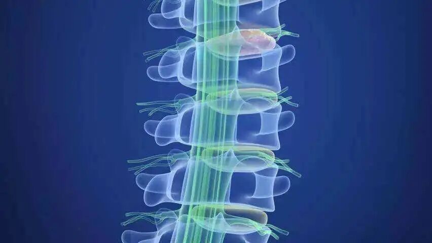 强生脊柱有哪些耗材热点 ｜ 脊椎国采公布中选结果！剩余量二次分配成最大亮点！_https://www.jmylbn.com_新闻资讯_第10张