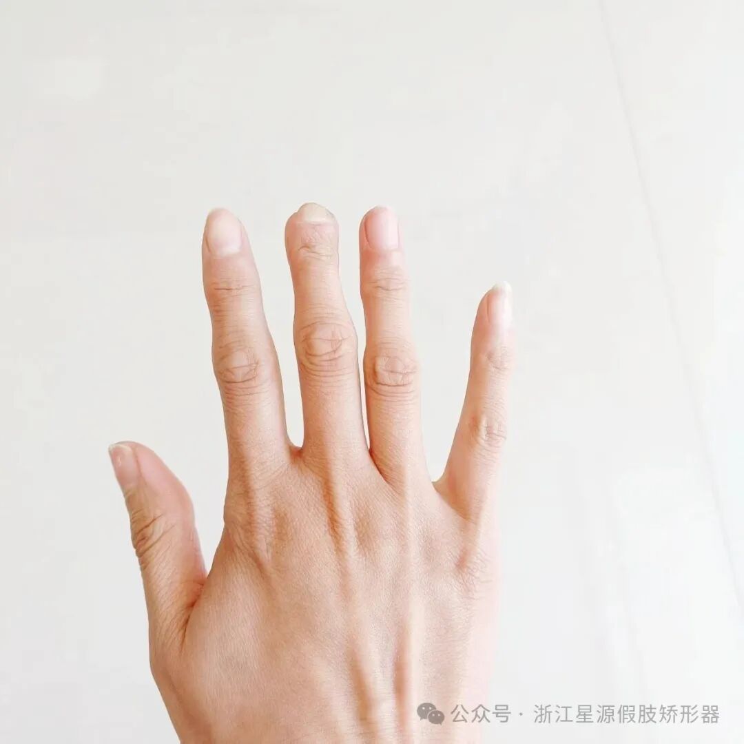 ͼƬ