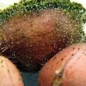 头部出现四种迹象，注意你的肝，肝不好，多“ 磨难”！