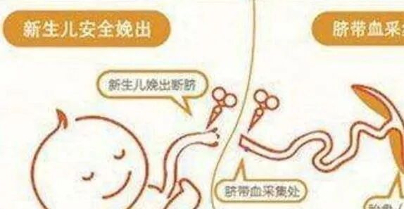 为什么剪脐带要先夹住脐带剪断的时候，到底是妈妈疼还是宝宝疼？别再猜了，看看就知道_https://www.jmylbn.com_新闻资讯_第10张