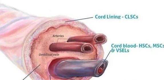 为什么剪脐带要先夹住脐带剪断的时候，到底是妈妈疼还是宝宝疼？别再猜了，看看就知道_https://www.jmylbn.com_新闻资讯_第9张