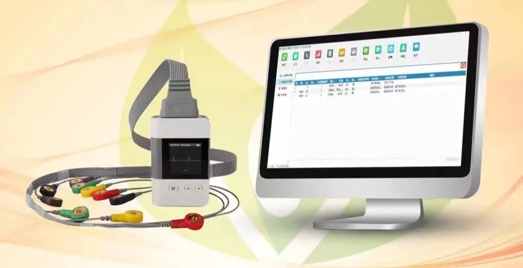动态心电仪怎么连接【新进设备二】“神奇”的动态心电图—您的心脏“记录仪”_https://www.jmylbn.com_新闻资讯_第1张