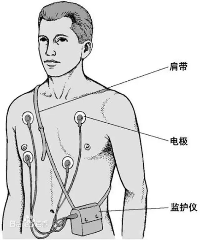 动态心电仪怎么连接【新进设备二】“神奇”的动态心电图—您的心脏“记录仪”_https://www.jmylbn.com_新闻资讯_第10张