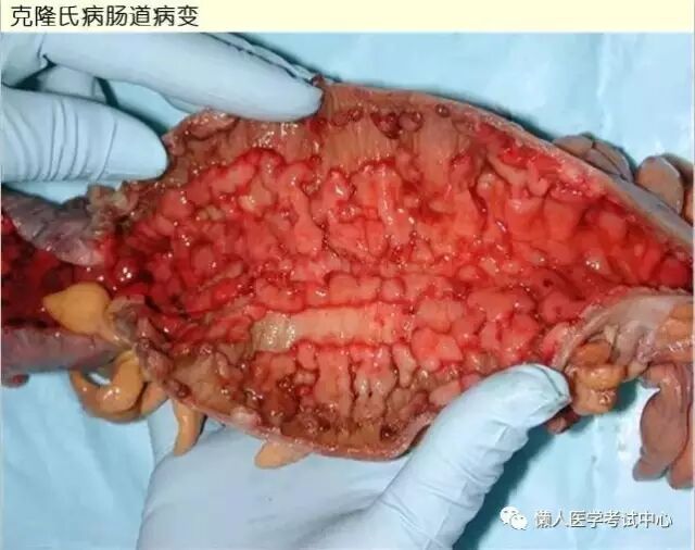 肠腺(分泌肠液,将麦芽糖分解成葡萄糖,将多肽分解成氨基酸,将小分子的