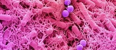 重大发现！肿瘤里发现大量细菌！