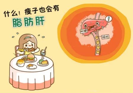 【医疗】别紧张！有了脂肪肝，调整膳食营养就可以了 | 美國貝佳天然藥業
