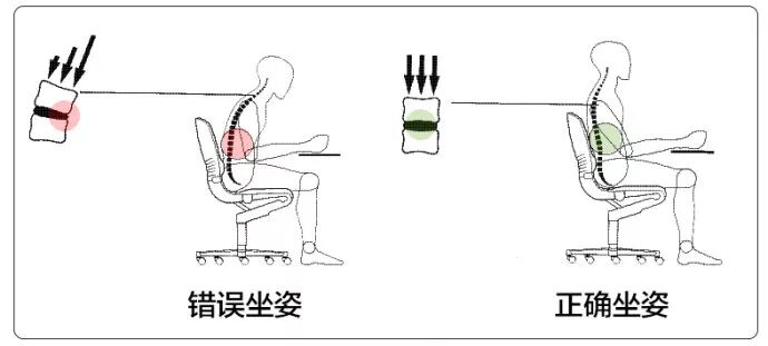 含胸、駝背、高低肩原來是脊柱側彎惹的禍？快來測測你的脊柱健康程度吧！ 健康 第3張