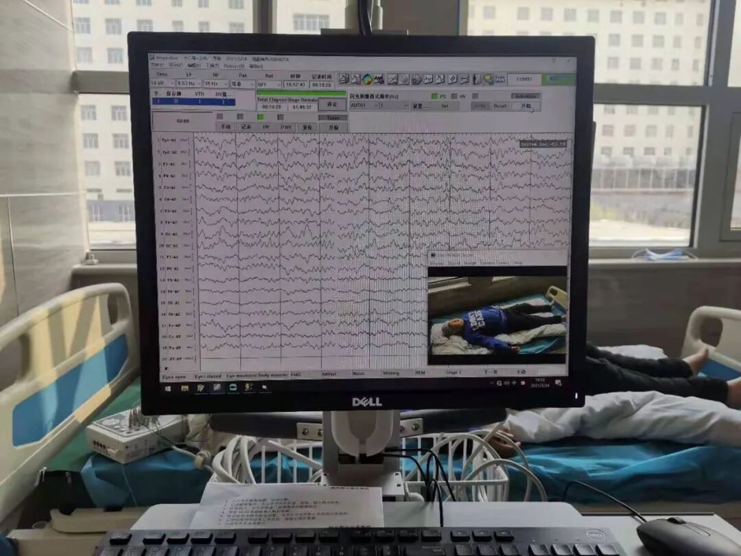 日本光电脑电图怎么样【医讯】大名县人民医院已正式投入使用视频脑电图_https://www.jmylbn.com_新闻资讯_第3张