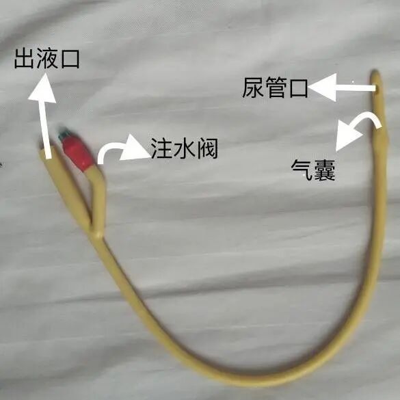 为什么要引流尿袋小管子，大作用——导尿管知识问答_https://www.jmylbn.com_新闻资讯_第1张