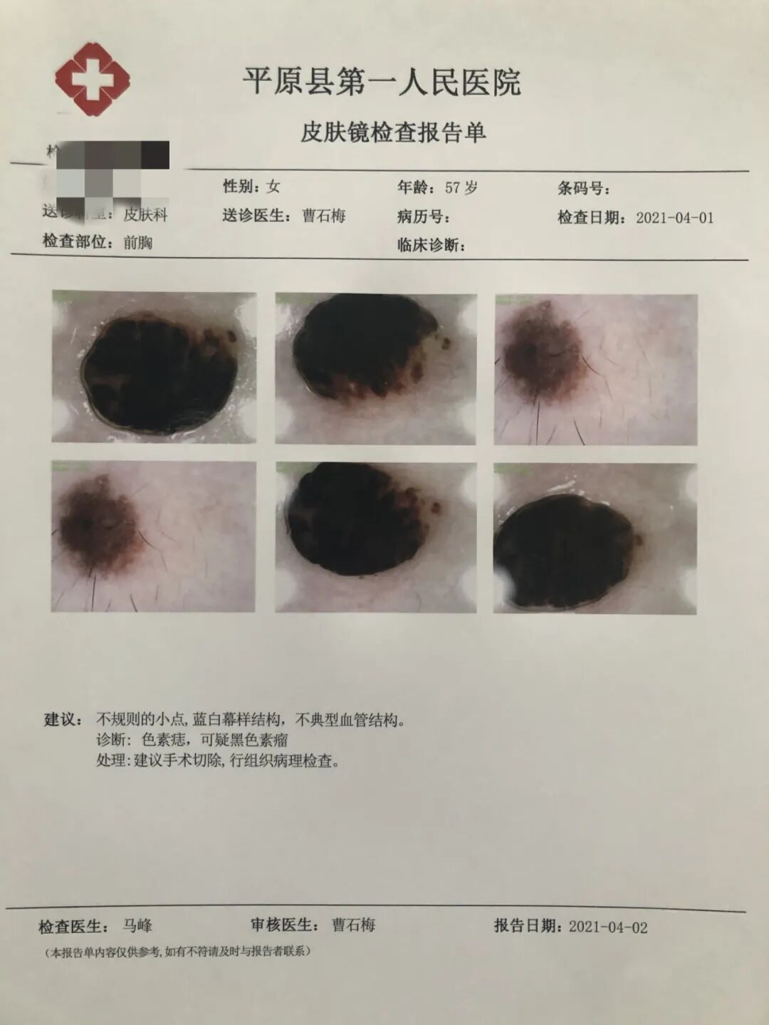 医用皮肤镜什么牌子好平原县第一人民医院皮肤科新引进皮肤镜“神器”，到底有多神奇？_https://www.jmylbn.com_新闻资讯_第6张