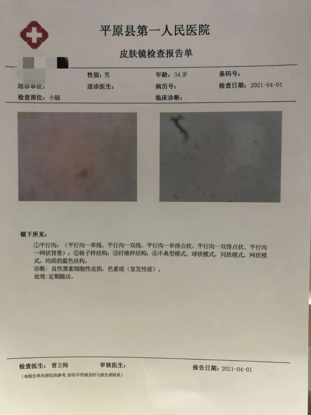 医用皮肤镜什么牌子好平原县第一人民医院皮肤科新引进皮肤镜“神器”，到底有多神奇？_https://www.jmylbn.com_新闻资讯_第7张