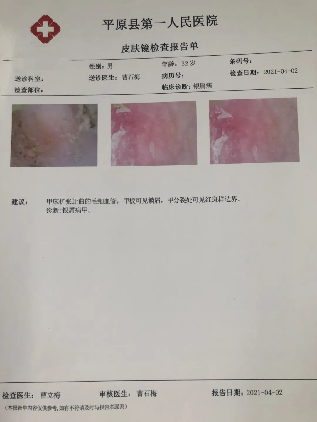 医用皮肤镜什么牌子好平原县第一人民医院皮肤科新引进皮肤镜“神器”，到底有多神奇？_https://www.jmylbn.com_新闻资讯_第8张