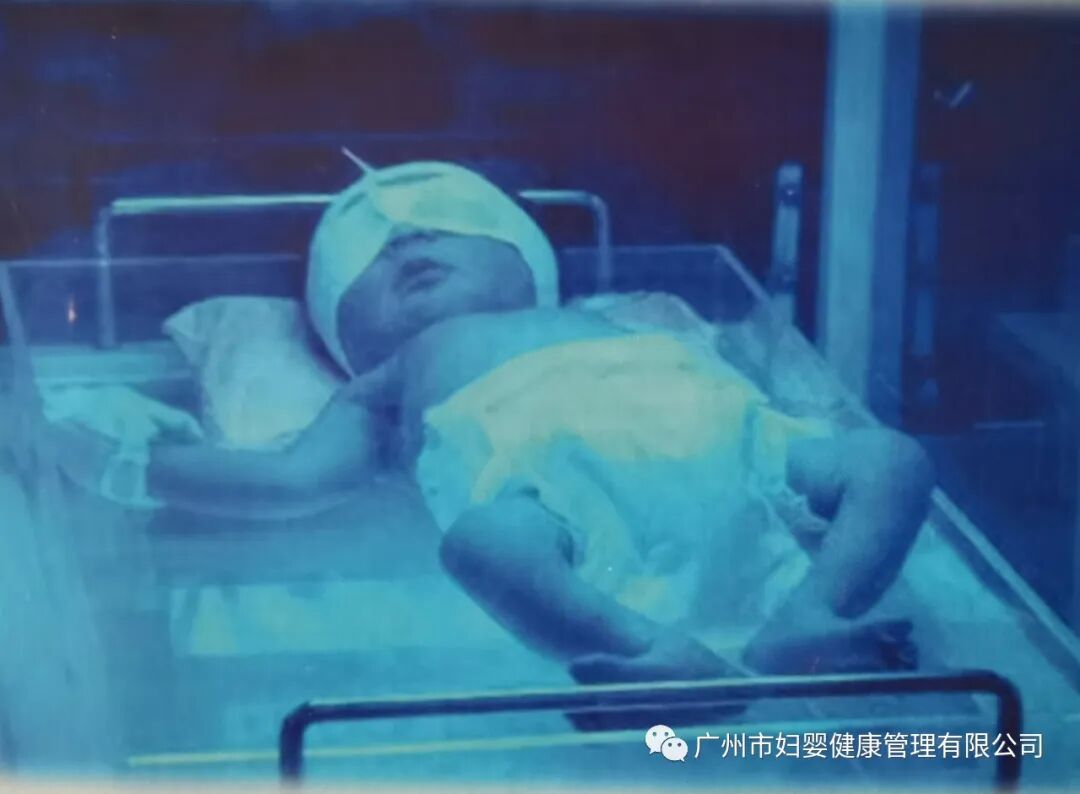 为什么要用光疗纸尿裤新品丨专为避蓝光设计的新生儿避蓝光护阴纸尿裤，婴儿光疗防护眼罩​_https://www.jmylbn.com_新闻资讯_第5张