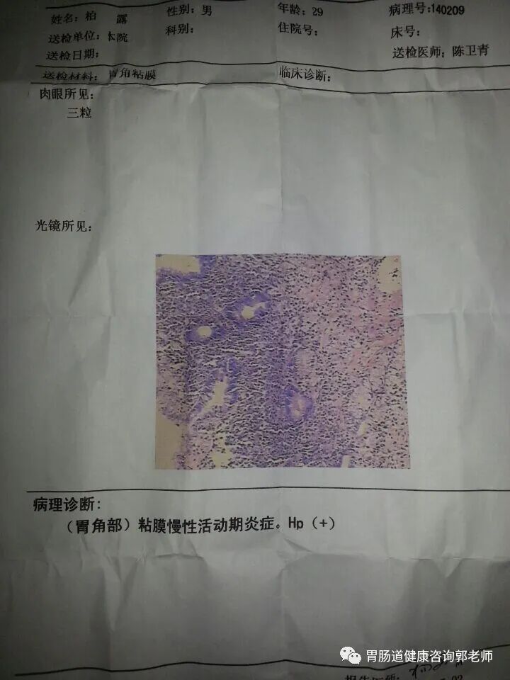 病理科医生教你看懂胃镜活检报告