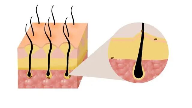 女性脱发严重，和哪些原因有关？来瞧瞧原因和调理方法