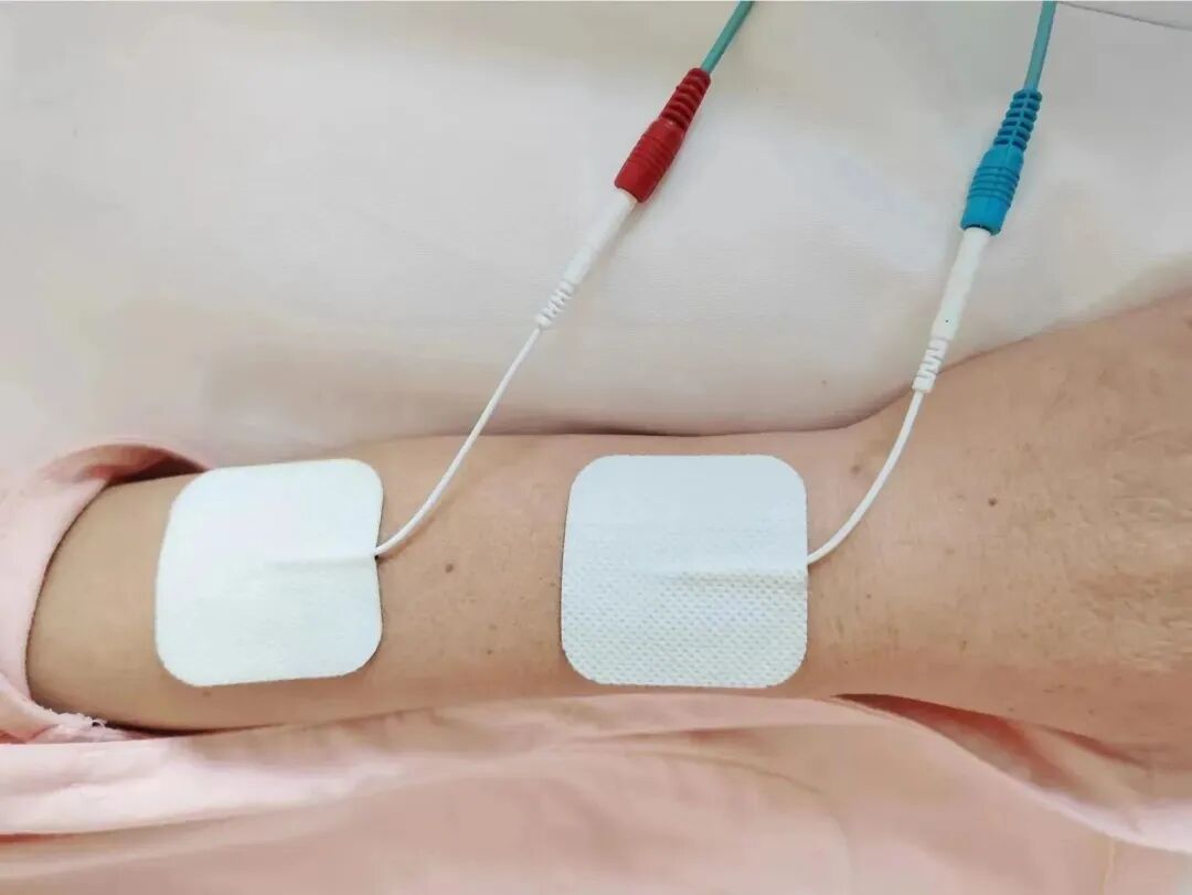 怎么买神经肌肉康复仪让肌肉“舞动”起来  肌体功能好起来——神经肌肉电刺激仪_https://www.jmylbn.com_新闻资讯_第3张