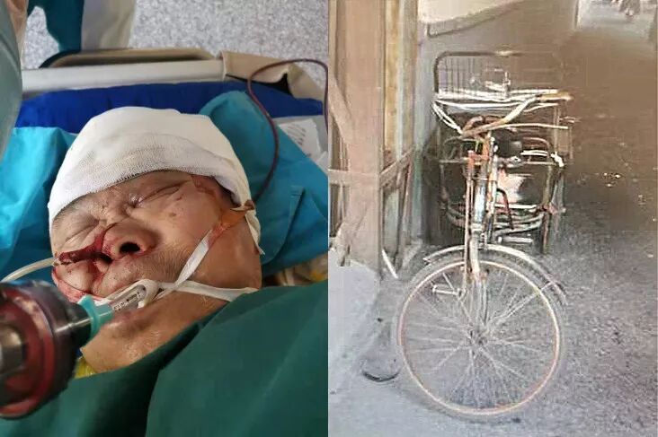 寻人启事！沧州发生一起交通事故！伤者身份不明