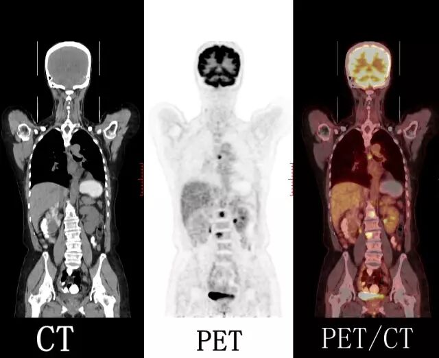 ct都有什么品牌【盘点】国产PET-CT品牌-上海聚慕医疗器械有限公司