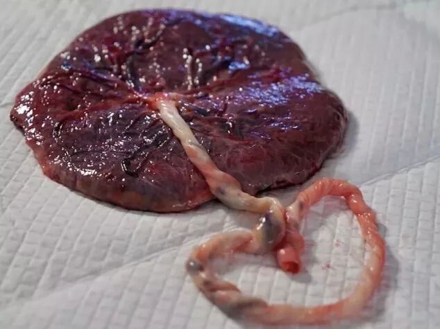 胎盘已被全世界人民吃出花样但这可能是有害的