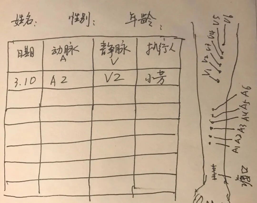 穿刺针怎么用【图说穿刺】用什么针 走什么位 ｜ 你的透析通道“命由针定”_https://www.jmylbn.com_新闻资讯_第7张