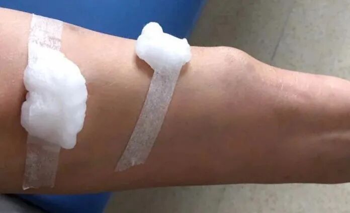 穿刺针怎么用【图说穿刺】用什么针 走什么位 ｜ 你的透析通道“命由针定”_https://www.jmylbn.com_新闻资讯_第15张