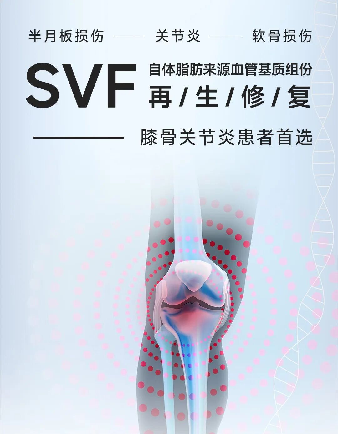 svf再生修复技术|膝骨关节疾病人群的首选