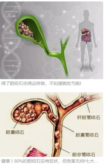 猪输尿管怎么吃（六）猪苓汤——肾结石，输尿管结石，浮肿_https://www.jmylbn.com_新闻资讯_第6张