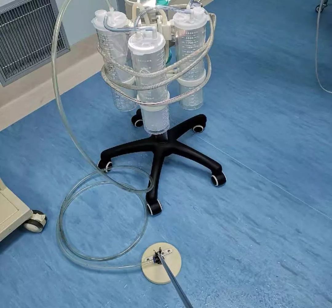 手术头皮夹怎么放护理创新的七个"金点子",太实用了!看看我们可以借鉴不?_新闻资讯_第7张_活检穿刺产品网 手术头皮夹怎么放护理创新的七个"金点子",太实用了!看看我们可以借鉴不?_https://www.jmylbn.com_新闻资讯_第7张