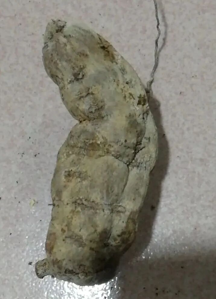 何首乌的样子图片？何首乌是云锦花纹还是左旋右旋？