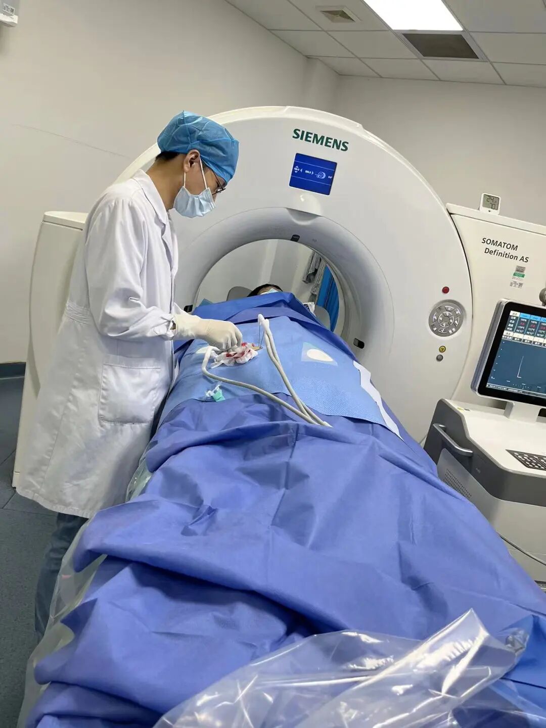 微波针是什么广药三院丨微波消融，一根针、10分钟肿瘤定点清除_https://www.jmylbn.com_新闻资讯_第6张