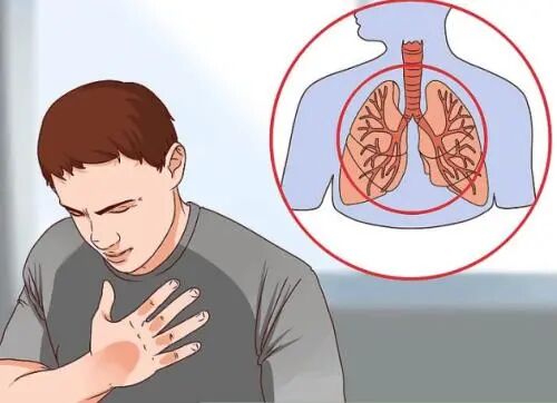 微波针是什么广药三院丨微波消融，一根针、10分钟肿瘤定点清除_https://www.jmylbn.com_新闻资讯_第2张