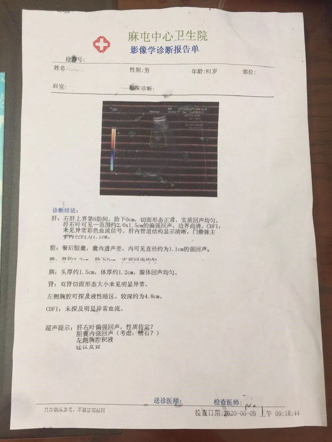 何丽霞用经方 泽漆汤治肺癌咯血胸水案 经方 微信公众号文章阅读 Wemp