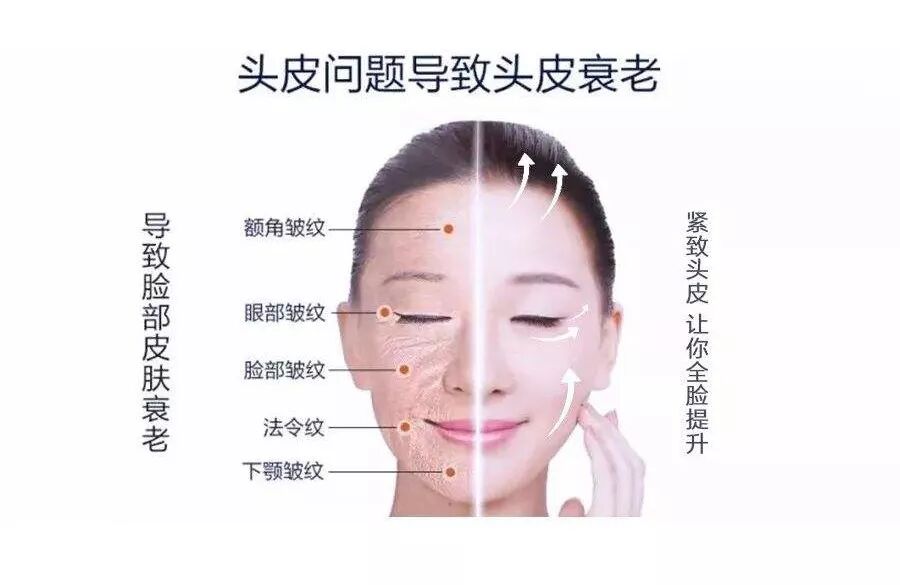 养发快讯丨关注头皮健康