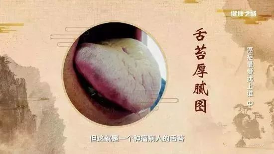 這三種體質的人易患癌！改善癌症體質，這樣做 健康 第5張