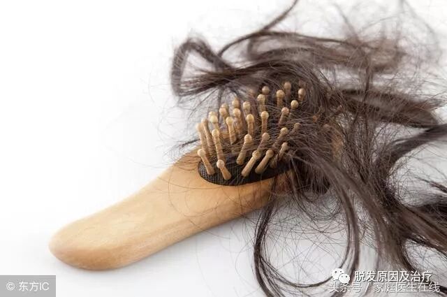 脂溢性脱发怎么治疗？多管齐下，还能拯救你的头发
