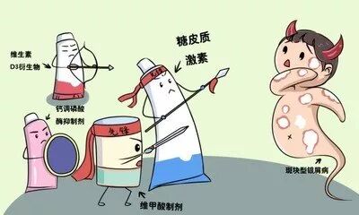 有一种甜蜜很脆弱——糖皮质激素会诱发骨质疏松