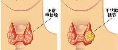 脖子上的“血鸡蛋”竟是它“翻脸不认人”