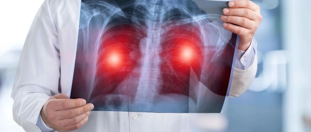 了解这种罕见的肺癌临床症状