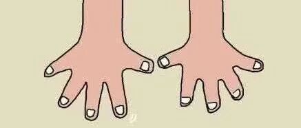 当灰指甲缠上纤纤玉指