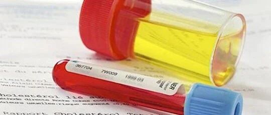 尿潜血阳性预示什么