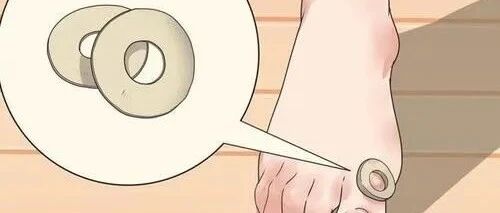 大妈自行修剪脚底疙瘩为何迟迟不愈