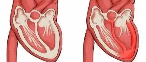 看似寻常感冒 其实潜藏杀机
