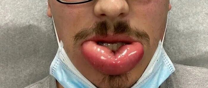 网友比惨大赛：谁敢比我惨？！