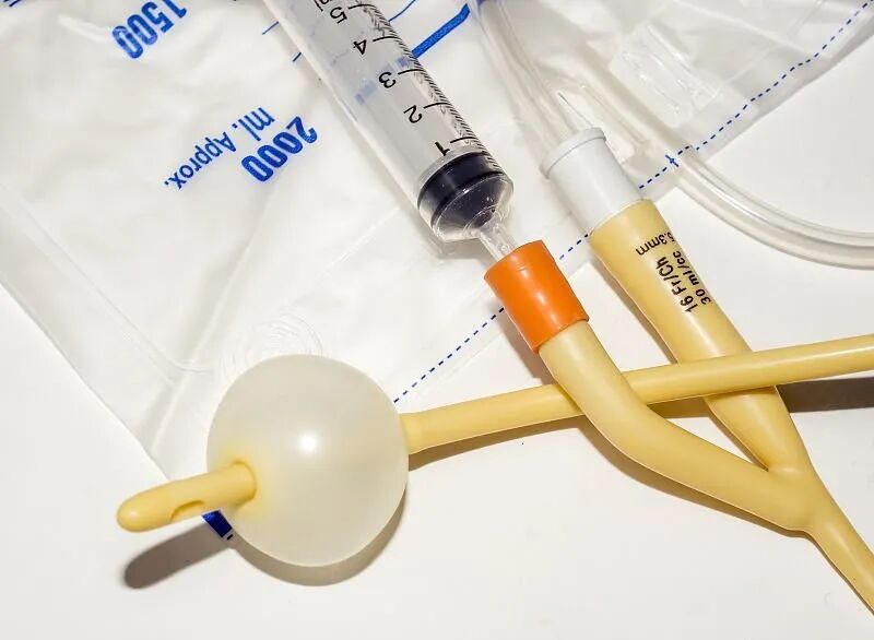 尿液引流袋怎么用居家护理｜膀胱造瘘居家护理要点_https://www.jmylbn.com_新闻资讯_第2张