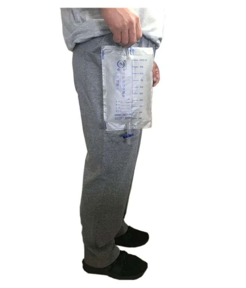 尿液引流袋怎么用居家护理｜膀胱造瘘居家护理要点_https://www.jmylbn.com_新闻资讯_第3张