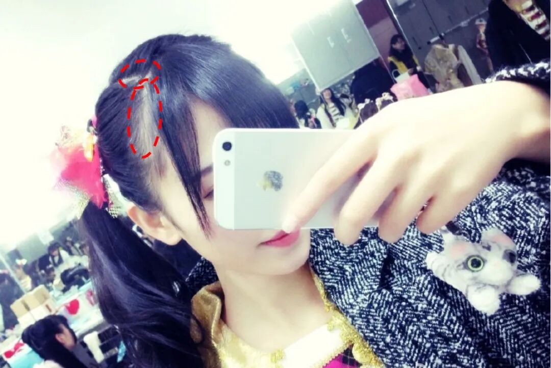 【整容】四千年美女鞠婧祎疑似连头皮都整了？！网友吐槽：是个狠人（组图） - 7