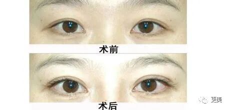【整容】四千年美女鞠婧祎疑似连头皮都整了？！网友吐槽：是个狠人（组图） - 62