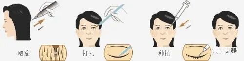 【整容】四千年美女鞠婧祎疑似连头皮都整了？！网友吐槽：是个狠人（组图） - 60
