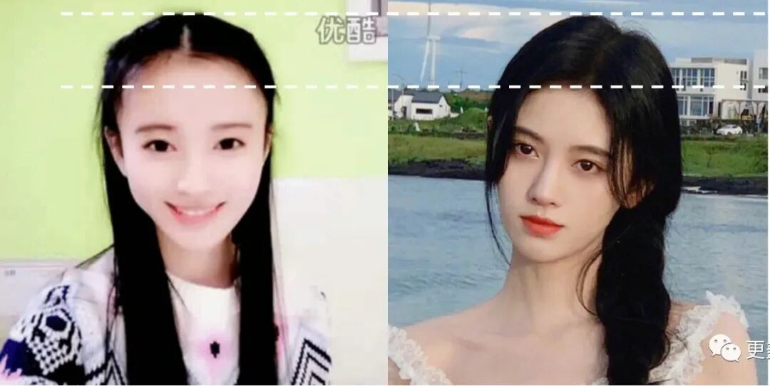 【整容】四千年美女鞠婧祎疑似连头皮都整了？！网友吐槽：是个狠人（组图） - 37