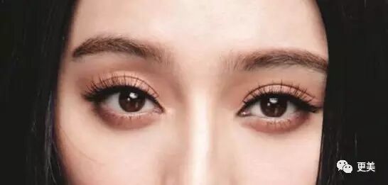 项目 科普|大小眼儿的解决方法~  所长看了一圈娱乐圈女明星,虽然多